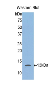 ACAN / Aggrecan Antibody - Western blot of recombinant Aggrecan.  This image was taken for the unconjugated form of this product. Other forms have not been tested.