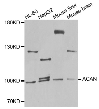 ACAN / Aggrecan Antibody - Western blot analysis of extracts of various cells.