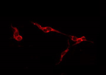 ACAN / Aggrecan Antibody - Staining HeLa cells by IF/ICC. The samples were fixed with PFA and permeabilized in 0.1% Triton X-100, then blocked in 10% serum for 45 min at 25°C. The primary antibody was diluted at 1:200 and incubated with the sample for 1 hour at 37°C. An Alexa Fluor 594 conjugated goat anti-rabbit IgG (H+L) Ab, diluted at 1/600, was used as the secondary antibody.