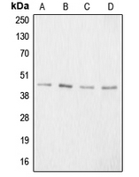 ACAN / Aggrecan Antibody - Western blot analysis of Aggrecan expression in HeLa colchicine-treated (A); mouse kidney (B); PC12 colchicine-treated (C); NIH3T3 (D) whole cell lysates.