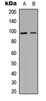 ACAN / Aggrecan Antibody - Western blot analysis of Aggrecan expression in A549 (A); PC12 (B) whole cell lysates.