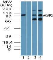 ACAP2 / Centaurin Beta 2 Antibody - Western blot of ACAP2 in human testis lysate in the 1) absence and 2) presence of immunizing peptide, 3) mouse testis lysate and 4) rat testis lysate using Peptide-affinity Purified Polyclonal Antibody to ACAP2 at 0.25 ug/ml. Goat anti-rabbit Ig HRP secondary antibody, and PicoTect ECL substrate solution, were used for this test.