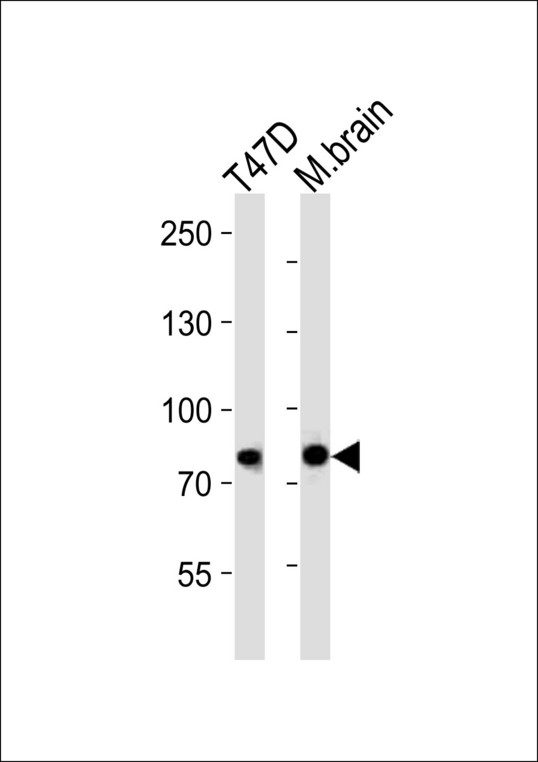 ACAP2 / Centaurin Beta 2 Antibody - Western blot of lysates from T47D cell line and mouse brain tissue (from left to right), using ACAP2 antibody diluted at 1:1000 at each lane. A goat anti-rabbit IgG H&L (HRP) at 1:10000 dilution was used as the secondary antibody. Lysates at 20 ug per lane.