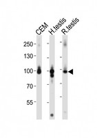 ACAP2 / Centaurin Beta 2 Antibody - Western blot of lysates from CEM cell line, human testis, rat testis tissue lysate (from left to right), using ACAP2 Antibody. A goat anti-rabbit IgG H&L (HRP) at 1:10000 dilution was used as the secondary antibody. Lysates at 20 ug per lane.