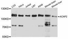 ACAP2 / Centaurin Beta 2 Antibody - Western blot analysis of extracts of various cell lines, using ACAP2 antibody at 1:1000 dilution. The secondary antibody used was an HRP Goat Anti-Rabbit IgG (H+L) at 1:10000 dilution. Lysates were loaded 25ug per lane and 3% nonfat dry milk in TBST was used for blocking. An ECL Kit was used for detection and the exposure time was 5s.