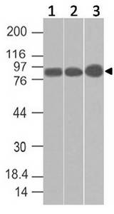 ACAP2 / Centaurin Beta 2 Antibody - Fig-1: Western blot analysis of CENTB2. Anti-CENTB2 antibody was used at 2 µg/ml on (1) h Kidney and 1 µg/ml on (2) m Kidney, (3) r Kidney lysates.