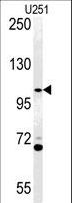 ACAP3 Antibody - Western blot of ACAP3 Antibody in U251 cell line lysates (35 ug/lane). ACAP3 (arrow) was detected using the purified antibody.