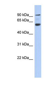ACAP3 Antibody - ACAP3 / CENTB5 antibody Western blot of Fetal Pancreas lysate. This image was taken for the unconjugated form of this product. Other forms have not been tested.