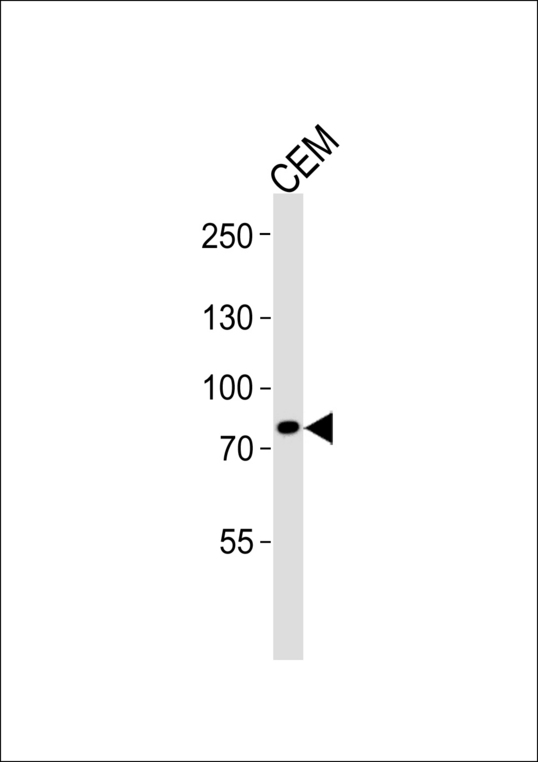 ACAP3 Antibody - Western blot of lysate from CEM cell line with ACAP3 Antibody. Antibody was diluted at 1:1000. A goat anti-rabbit IgG H&L (HRP) at 1:5000 dilution was used as the secondary antibody. Lysate at 35 ug.