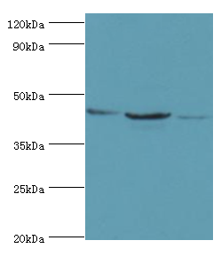 ACAT1 Antibody - Western blot. All lanes: ACAT1 antibody at 6 ug/ml. Lane 1: mouse skeletal muscle tissue. Lane 2: rat heart tissue. Lane 3: THP-1 whole cell lysate. Secondary antibody: Goat polyclonal to rabbit at 1:10000 dilution. Predicted band size: 45 kDa. Observed band size: 45 kDa.
