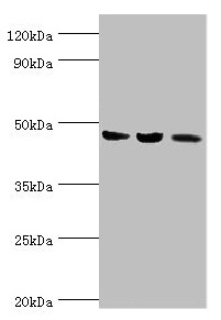 ACAT1 Antibody - Western blot All lanes: ACAT1 antibody at 6µg/ml Lane 1: Mouse skeletal musce tissue Lane 2: Rat heart tissue Lane 3: THP-1 whole cell lysate Secondary Goat polyclonal to rabbit IgG at 1/10000 dilution Predicted band size: 46, 18 kDa Observed band size: 46 kDa