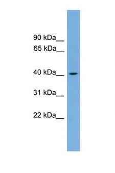 ACAT1 Antibody - ACAT1 antibody Western blot of HepG2 Cell lysate. Antibody concentration 1 ug/ml. This image was taken for the unconjugated form of this product. Other forms have not been tested.