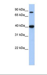 ACAT1 Antibody - Fetal heart lysate. Antibody concentration: 1.0 ug/ml. Gel concentration: 12%.  This image was taken for the unconjugated form of this product. Other forms have not been tested.