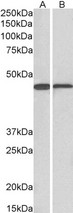 ACAT1 Antibody - ACAT1 (aa253-266) antibody (0.1ug/ml) staining of Mouse (A) and Rat (B) Liver lysate (35ug protein in RIPA buffer). Primary incubation was 1 hour. Detected by chemiluminescence.