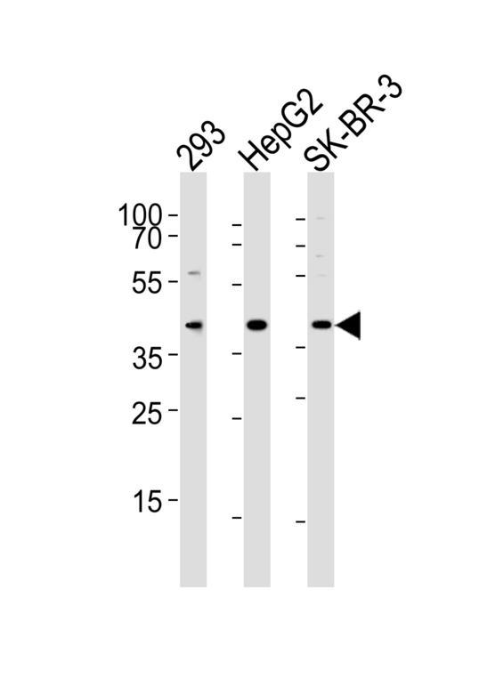ACAT1 Antibody - Western blot of lysates from 293, HepG2, SK-BR-3 cell line (from left to right) with ACAT1 Antibody. Antibody was diluted at 1:1000 at each lane. A goat anti-rabbit IgG H&L (HRP) at 1:5000 dilution was used as the secondary antibody. Lysates at 35 ug per lane.
