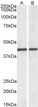 ACAT1 Antibody - Biotinylated Goat Anti-ACAT1 (aa253-266) Antibody (0.1µg/ml) staining of Mouse (A) and Rat (B) Liver lysates (35µg protein in RIPA buffer), exactly mirroring its parental non-biotinylated product. Primary incubation was 1 hour. Detected by chemiluminescencence, using streptavidin-HRP and using NAP blocker as a substitute for skimmed milk.