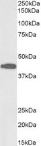 ACAT1 Antibody - Biotinylated Goat Anti-ACAT1 (aa257-269) Antibody (0.1µg/ml) staining of Mouse Liver lysate (35µg protein in RIPA buffer), exactly mirroring its parental non-biotinylated product. Primary incubation was 1 hour. Detected by chemiluminescencence, using streptavidin-HRP and using NAP blocker as a substitute for skimmed milk.