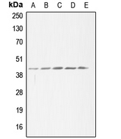 ACAT1 Antibody - Western blot analysis of ACAT1 expression in HeLa (A); HEK293T (B); SP2/0 (C); H9C2 (D); THP1 (E) whole cell lysates.
