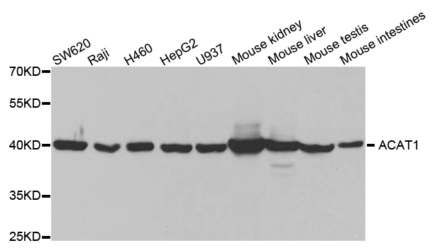 ACAT1 Antibody - Western blot analysis of extracts of various cell lines.