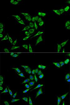 ACAT1 Antibody - Immunofluorescence analysis of A549 cells.