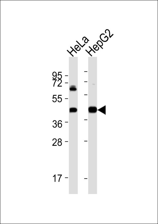 ACAT1 Antibody - All lanes : Anti-ACAT1 Antibody at 1:1000 dilution Lane 1: HeLa whole cell lysates Lane 2: HepG2 whole cell lysates Lysates/proteins at 20 ug per lane. Secondary Goat Anti-Rabbit IgG, (H+L),Peroxidase conjugated at 1/10000 dilution Predicted band size : 45 kDa Blocking/Dilution buffer: 5% NFDM/TBST.
