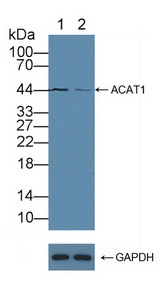 ACAT1 Antibody - Knockout Varification: Lane 1: Wild-type A549 cell lysate; Lane 2: ACAT1 knockout A549 cell lysate; Predicted MW: 17,45kd Observed MW: 44kd Primary Ab: 1µg/ml Rabbit Anti-Human ACAT1 Antibody Second Ab: 0.2µg/mL HRP-Linked Caprine Anti-Rabbit IgG Polyclonal Antibody