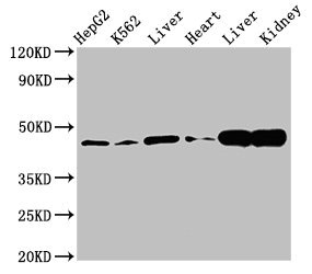 ACAT1 Antibody - Western Blot Positive WB detected in:HepG2 whole cell lysate,K562 whole cell lysate,Rat liver tissue,Mouse heart tissue,Mouse liver tissue Mouse kindey tissue All Lanes:ACAT1 antibody at 3µg/ml Secondary Goat polyclonal to rabbit IgG at 1/50000 dilution Predicted band size: 46,18 KDa Observed band size: 46 KDa