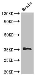 ACAT1 Antibody - Western Blot Positive WB detected in: Mouse brain tissue All lanes: THAP7 antibody at 3µg/ml Secondary Goat polyclonal to rabbit IgG at 1/50000 dilution Predicted band size: 35 kDa Observed band size: 35 kDa
