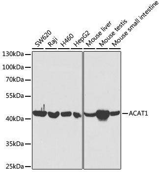 ACAT1 Antibody - Western blot analysis of extracts of various cell lines, using ACAT1 antibody at 1:5000 dilution. The secondary antibody used was an HRP Goat Anti-Rabbit IgG (H+L) at 1:10000 dilution. Lysates were loaded 25ug per lane and 3% nonfat dry milk in TBST was used for blocking. An ECL Kit was used for detection and the exposure time was 10s.