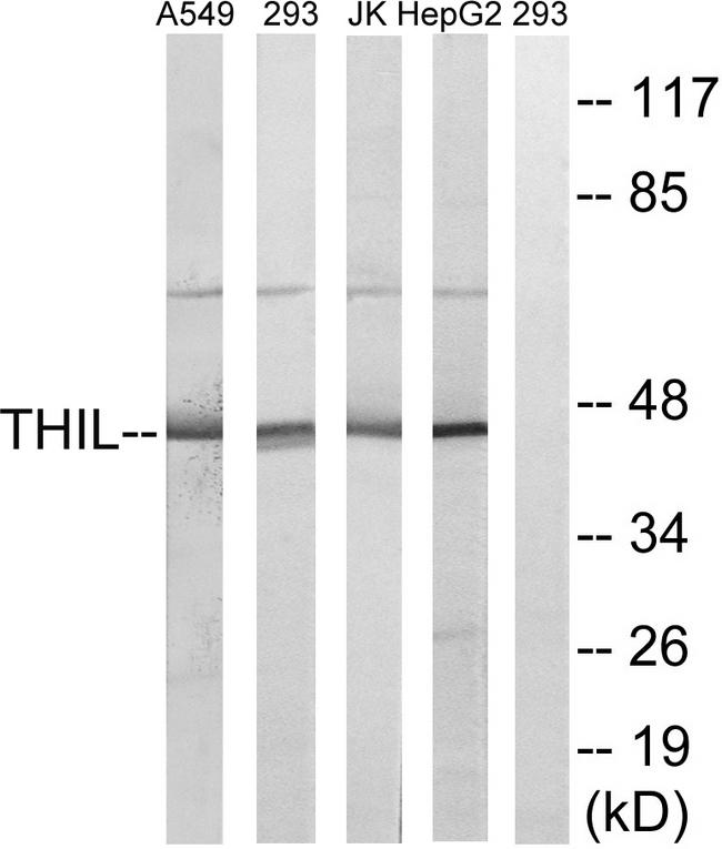 ACAT1 Antibody - Western blot analysis of extracts from A549 cells, 293 cells, Jurkat cells and HepG2 cells, using ACAT1 antibody.