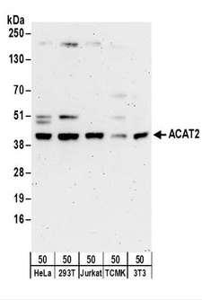 ACAT2 Antibody - Detection of Human and Mouse ACAT2 by Western Blot. Samples: Whole cell lysate (50 ug) from HeLa, 293T, Jurkat, mouse TCMK-1, and mouse NIH3T3 cells. Antibodies: Affinity purified rabbit anti-ACAT2 antibody used for WB at 0.1 ug/ml. Detection: Chemiluminescence with an exposure time of 3 minutes.