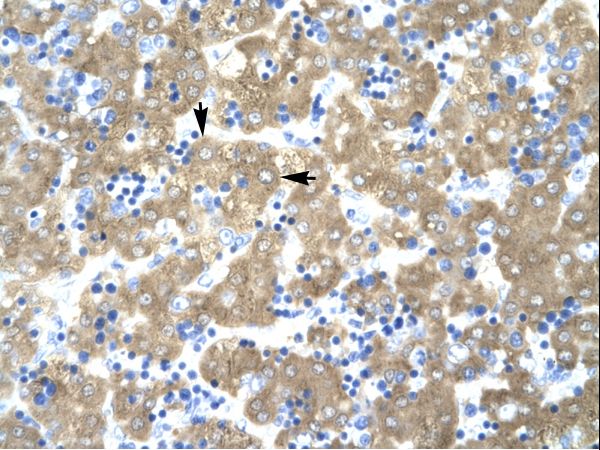ACAT2 Antibody - ACAT2 antibody ARP32790_T100-NP_005882-ACAT2 (acetyl-Coenzyme A acetyltransferase 2 (acetoacetyl Coenzyme A thiolase)) Antibody was used in IHC to stain formalin-fixed, paraffin-embedded human liver.  This image was taken for the unconjugated form of this product. Other forms have not been tested.
