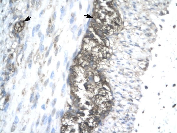 ACAT2 Antibody - ACAT2 antibody ARP32791_T100-NP_005882-ACAT2 (acetyl-Coenzyme A acetyltransferase 2 (acetoacetyl Coenzyme A thiolase)) Antibody was used in IHC to stain formalin-fixed, paraffin-embedded human stomach.  This image was taken for the unconjugated form of this product. Other forms have not been tested.