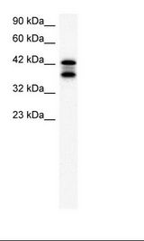 ACAT2 Antibody - K562 Cell Lysate.  This image was taken for the unconjugated form of this product. Other forms have not been tested.