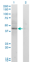 ACAT2 Antibody - Western Blot analysis of ACAT2 expression in transfected 293T cell line by ACAT2 monoclonal antibody (M01), clone 4A5.Lane 1: ACAT2 transfected lysate(41.4 KDa).Lane 2: Non-transfected lysate.
