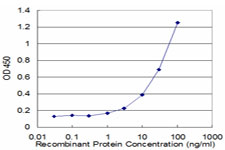 ACAT2 Antibody - Detection limit for recombinant GST tagged ACAT2 is approximately 1 ng/ml as a capture antibody.