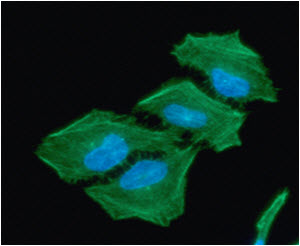 ACAT2 Antibody - ICC/IF analysis of ACAT2 in HeLa cells line, stained with DAPI (Blue) for nucleus staining and monoclonal anti-human ACAT2 antibody (1:100) with goat anti-mouse IgG-Alexa fluor 488 conjugate (Green).