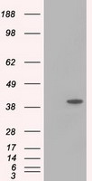 ACAT2 Antibody - HEK293T cells were transfected with the pCMV6-ENTRY control (Left lane) or pCMV6-ENTRY ACAT2 (Right lane) cDNA for 48 hrs and lysed. Equivalent amounts of cell lysates (5 ug per lane) were separated by SDS-PAGE and immunoblotted with anti-ACAT2.