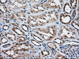 ACAT2 Antibody - IHC of paraffin-embedded Human Kidney tissue using anti-ACAT2 mouse monoclonal antibody. (Dilution 1:50).