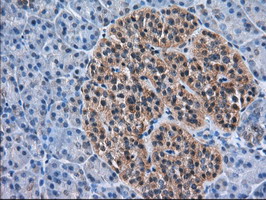 ACAT2 Antibody - IHC of paraffin-embedded Human pancreas tissue using anti-ACAT2 mouse monoclonal antibody. (Dilution 1:50).