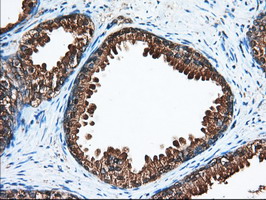 ACAT2 Antibody - IHC of paraffin-embedded Human prostate tissue using anti-ACAT2 mouse monoclonal antibody. (Dilution 1:50).