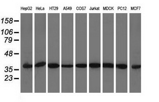 ACAT2 Antibody - Western blot analysis of extracts (35ug) from 9 different cell lines by using anti-ACAT2 monoclonal antibody.
