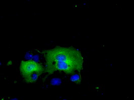ACAT2 Antibody - Anti-ACAT2 mouse monoclonal antibody  immunofluorescent staining of COS7 cells transiently transfected by pCMV6-ENTRY ACAT2.