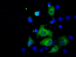 ACAT2 Antibody - Anti-ACAT2 mouse monoclonal antibody  immunofluorescent staining of COS7 cells transiently transfected by pCMV6-ENTRY ACAT2.