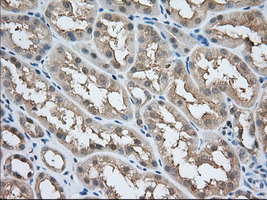 ACAT2 Antibody - IHC of paraffin-embedded Human Kidney tissue using anti-ACAT2 mouse monoclonal antibody. (Dilution 1:50).