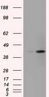 ACAT2 Antibody - HEK293T cells were transfected with the pCMV6-ENTRY control (Left lane) or pCMV6-ENTRY ACAT2 (Right lane) cDNA for 48 hrs and lysed. Equivalent amounts of cell lysates (5 ug per lane) were separated by SDS-PAGE and immunoblotted with anti-ACAT2.