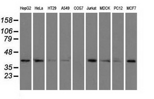 ACAT2 Antibody - Western blot of extracts (35 ug) from 9 different cell lines by using anti-ACAT2 monoclonal antibody.