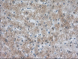 ACAT2 Antibody - IHC of paraffin-embedded Human liver tissue using anti-ACAT2 mouse monoclonal antibody. (Dilution 1:50).