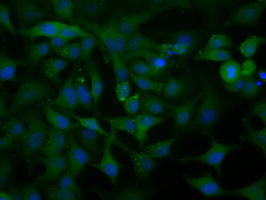 ACAT2 Antibody - Immunofluorescent staining of HeLa cells using anti-ACAT2 mouse monoclonal antibody.