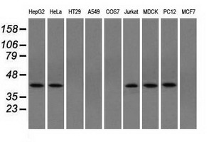 ACAT2 Antibody - Western blot of extracts (35 ug) from 9 different cell lines by using anti-ACAT2 monoclonal antibody.